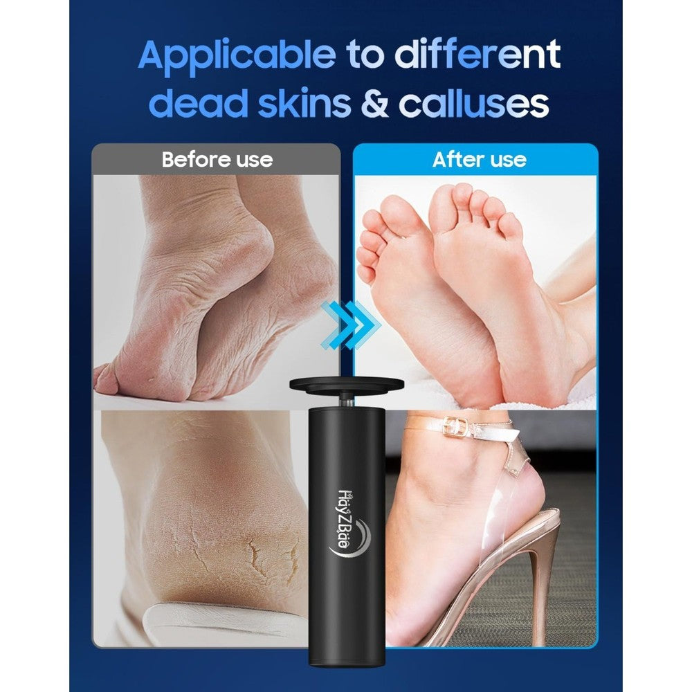 Electric Callus Remover for Feet, 12V High Power, with 60 Pcs Sanding Discs