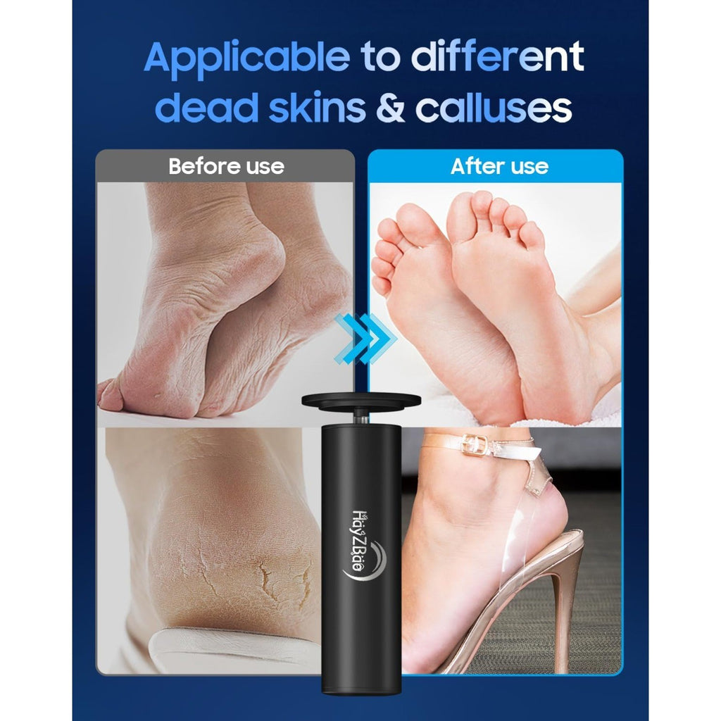 Electric Callus Remover for Feet, 12V High Power, with 60 Pcs Sanding Discs