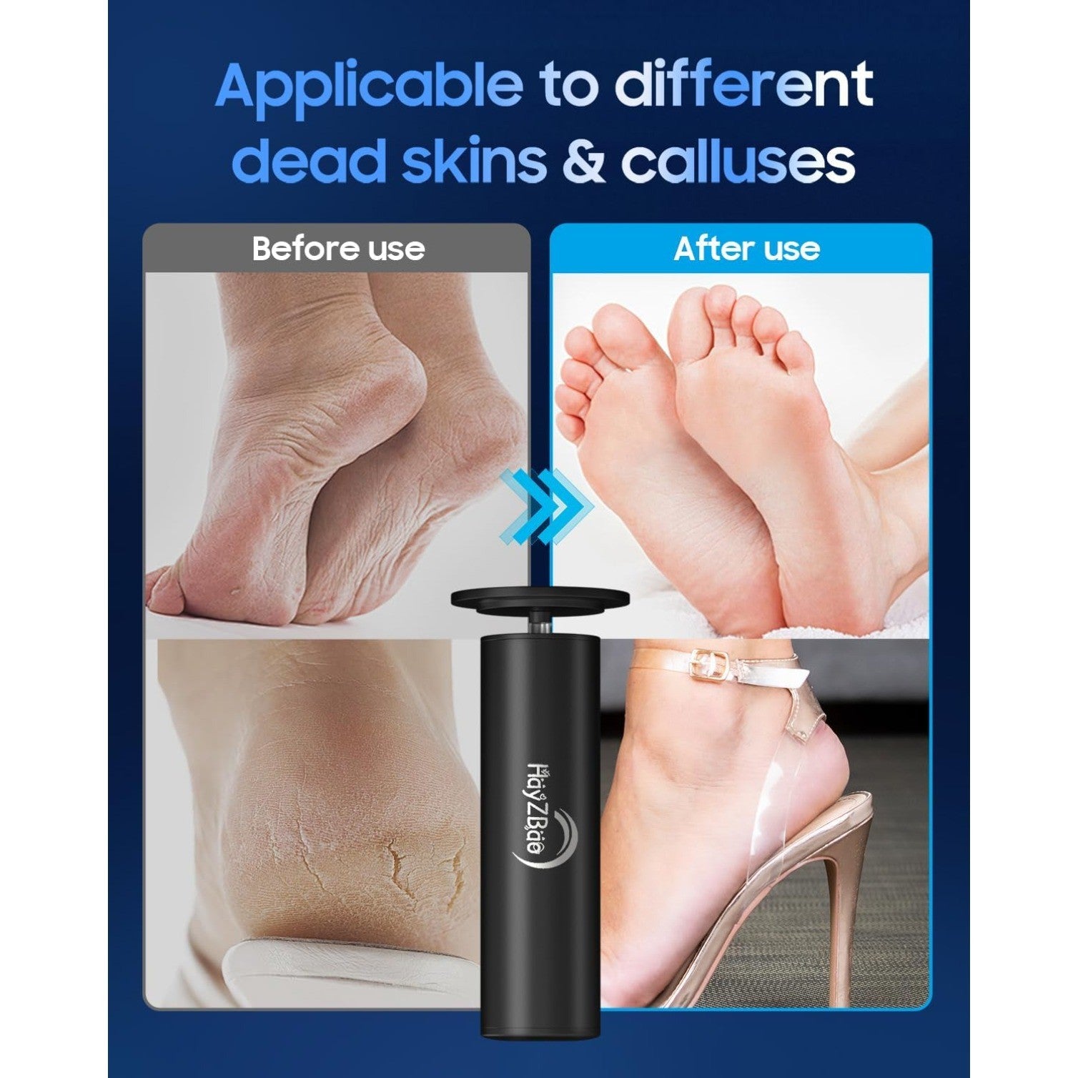 Electric Callus Remover for Feet, 12V High Power, with 60 Pcs Sanding Discs