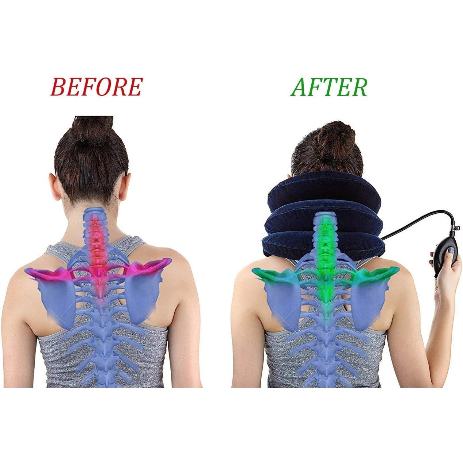 Cervical Neck Traction Device Inflatable Neck Stretcher
